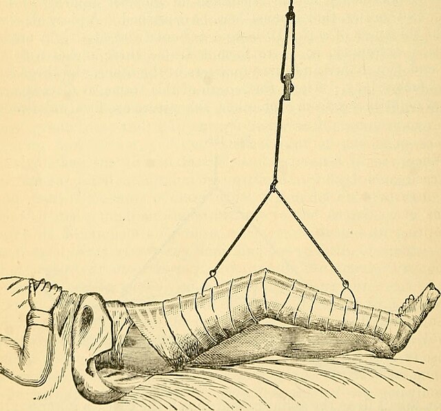 The Discovery That Changed Surgery Forever: The Moment Cleanliness Saved Lives